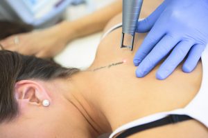 Épilation laser, épilation définitive, injections Botox, acide hyaluronique, cryolipolyse, rajeunissement cutané, relâchement cutané, taches pigmentaires, couperose, erythrose, lasers, traitements vasculaires, détatouage, radiofréquence, LED, membres inférieurs, val d’Europe, serris, 77700
