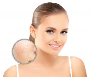 Épilation laser, épilation définitive, injections Botox, acide hyaluronique, cryolipolyse, rajeunissement cutané, relâchement cutané, taches pigmentaires, couperose, erythrose, lasers, traitements vasculaires, détatouage, radiofréquence, LED, membres inférieurs, val d’Europe, serris, 77700