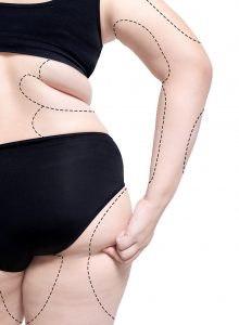 Épilation laser, épilation définitive, injections Botox, acide hyaluronique, cryolipolyse, rajeunissement cutané, relâchement cutané, taches pigmentaires, couperose, erythrose, lasers, traitements vasculaires, détatouage, radiofréquence, LED, membres inférieurs, val d’Europe, serris, 77700