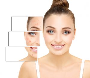 Épilation laser, épilation définitive, injections Botox, acide hyaluronique, cryolipolyse, rajeunissement cutané, relâchement cutané, taches pigmentaires, couperose, erythrose, lasers, traitements vasculaires, détatouage, radiofréquence, LED, membres inférieurs, val d’Europe, serris, 77700