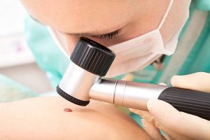 chirurgie dermatologique